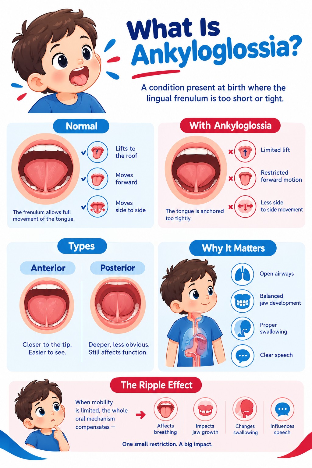 Understanding Ankyloglossia A Friendly Guide ()