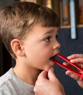 oral plament therapy photo 1